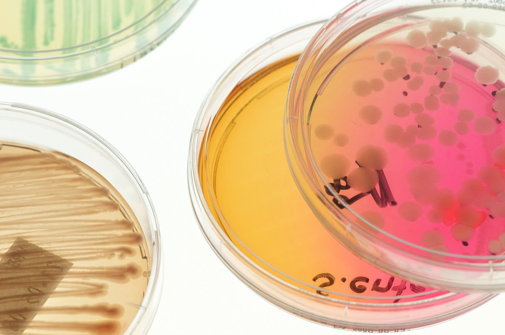 Neuer CampylobacterGrenzwert ab 2018 KIN
